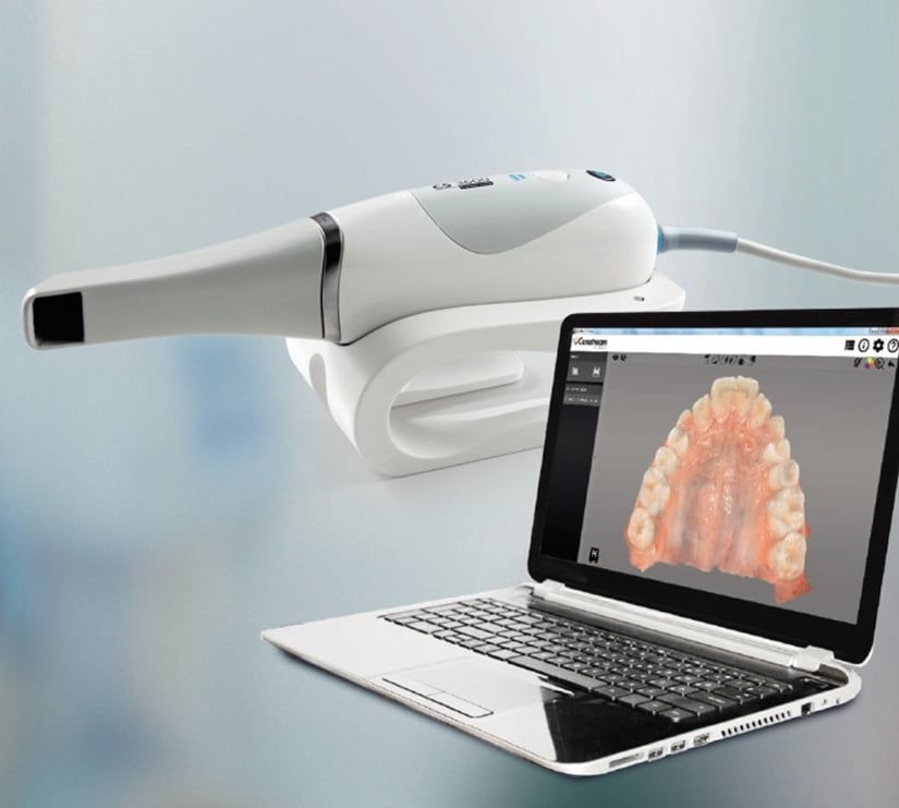 Escáner Intraoral Dental 3D En Valencia